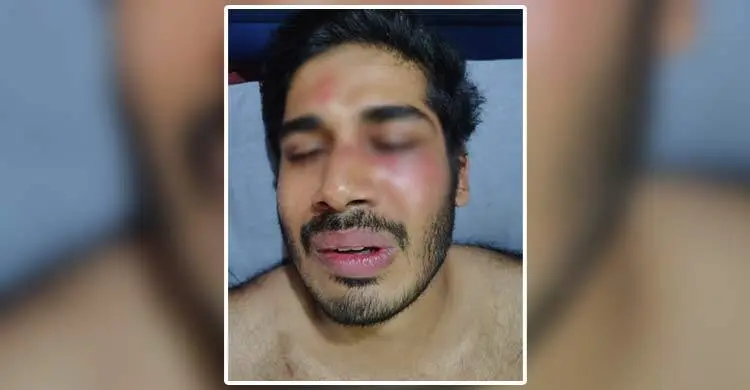 অতিরিক্ত ভাড়া চাওয়ার প্রতিবাদ করায় চবি শিক্ষার্থীকে মারধর