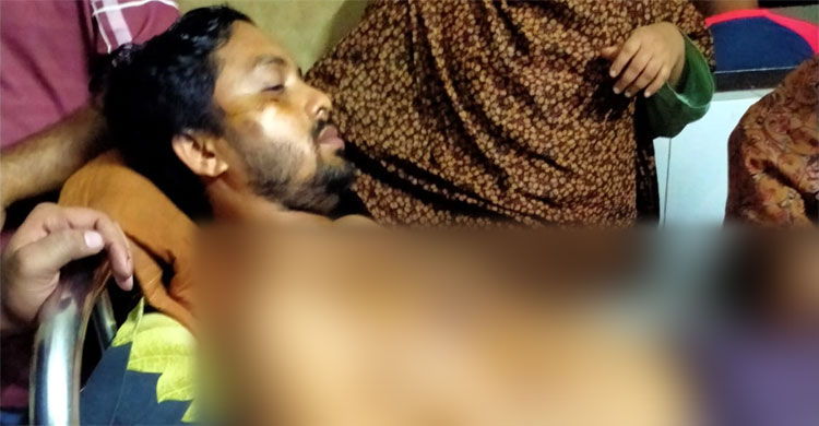 শরীরে ২২ ছররা গুলি নিয়ে জীবন কাটাচ্ছেন জুলাই যোদ্ধা আলাউদ্দিন