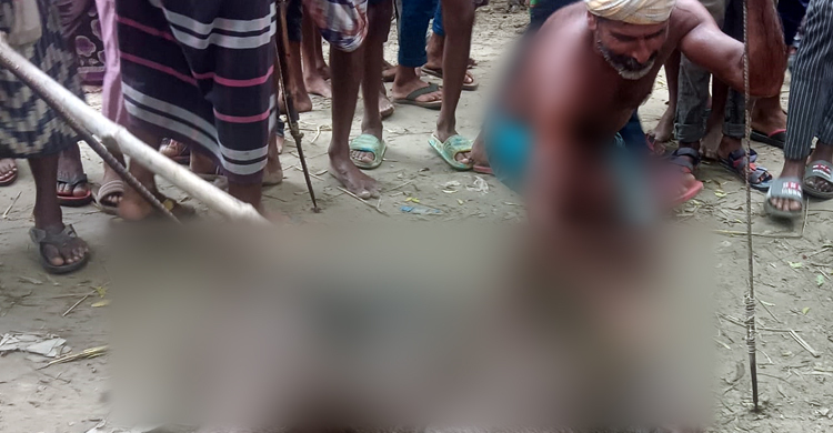 চাঁপাইনবাবগঞ্জে শূকরের কামড়ে আহত ৬