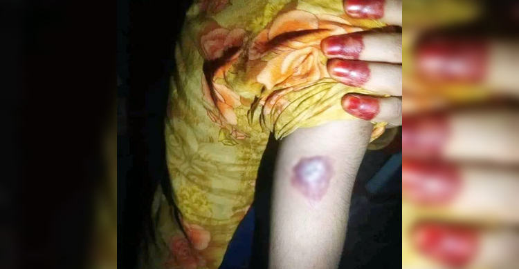 নার্সের বাসায় দেড় বছর ধরে চলা নির্যাতনের বর্ণনা দিলো গৃহপরিচারিকা