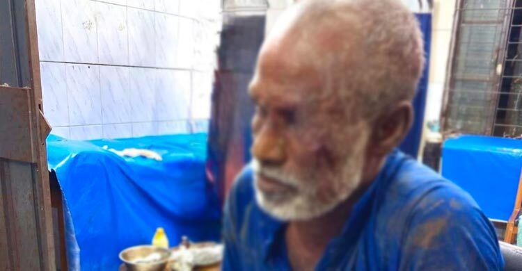 ‘চোরের’ রডের আঘাতে আহত ৩, পরে নিজেও গণধোলাইয়ের শিকার