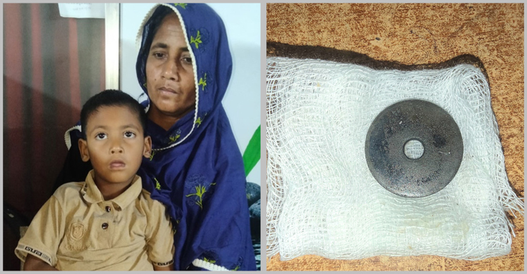 ১৩ দিন পর জানা গেলো শিশুর গলায় আটকে আছে লোহার ওয়াশার