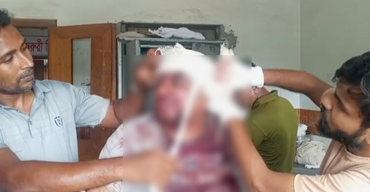 দিনদুপুরে জুয়েলারি ব্যবসায়ীকে কুপিয়ে স্বর্ণ লুটের চেষ্টা