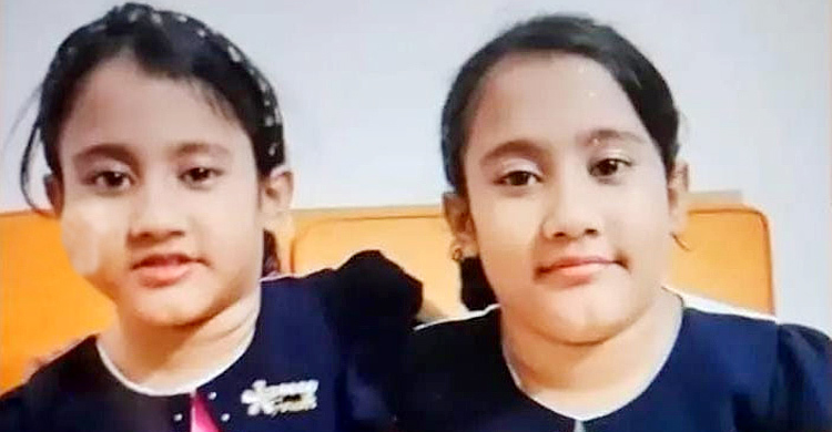 সিসিইউতে যন্ত্রণায় কাতরাচ্ছে সারিনা-সাইবা যমজ দুই বোন
