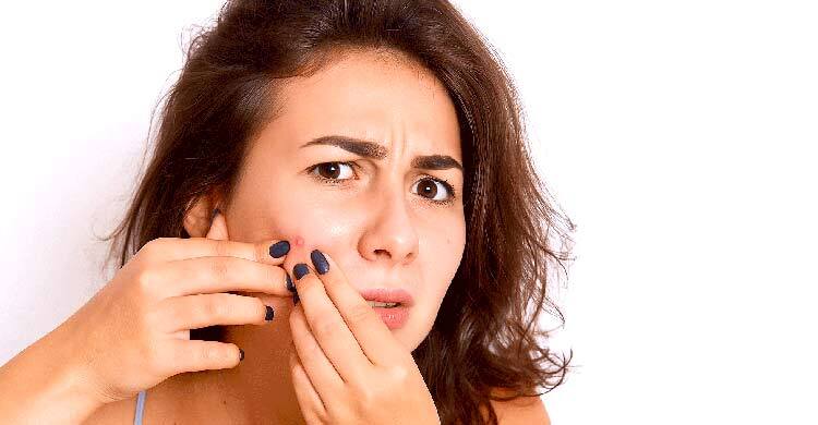 মুখের ব্রণ চেপে ফাটালে হতে পারে প্যারালাইসিস