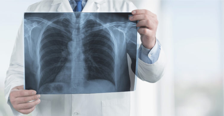 ফুসফুসের রোগ সিওপিডি কী? জানুন লক্ষণ