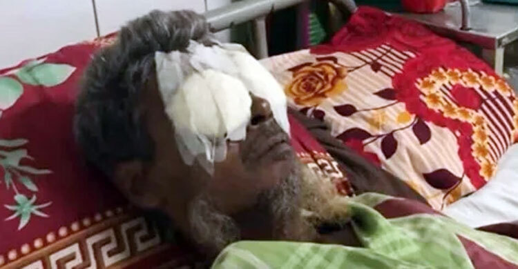ভাইয়ের কাছে রাখা টাকা-সোনা ফেরত চাওয়ায় চোখ উপড়ে ফেললো দুই ভাই
