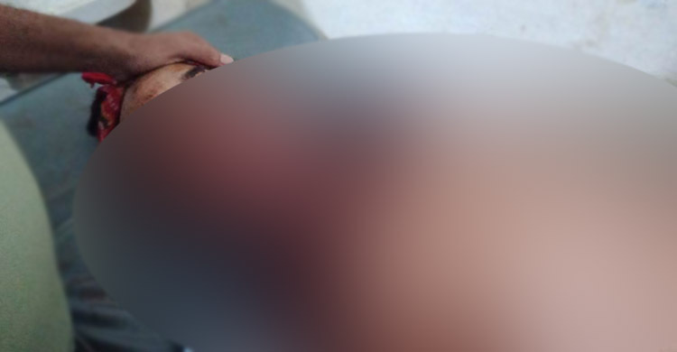 ঈদের ছুটিতে যশোরে গিয়ে মোটরসাইকেলের ধাক্কায় আইনজীবীর মৃত্যু