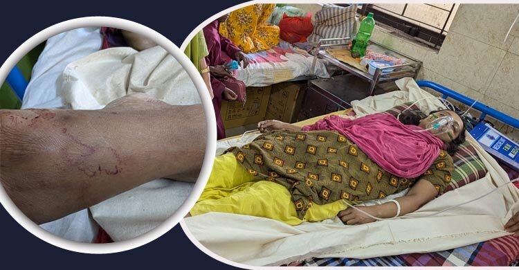 রান্নাঘরে সাপের কামড়ে প্রাণ গেলো নারীর