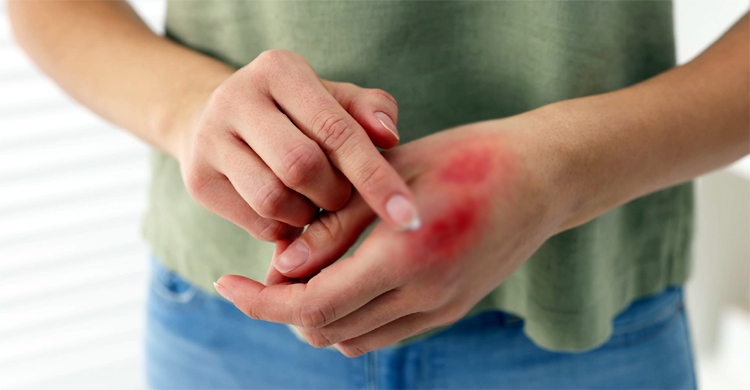 হঠাৎ পুড়ে গেলে কী করবেন