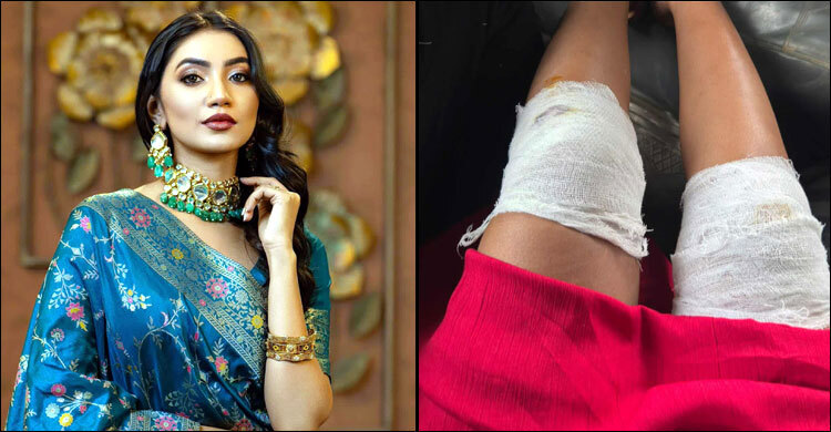 শুটিং সেটে আহত অভিনেত্রী সুনেরাহ