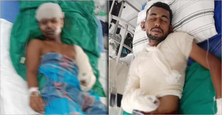 এক পুলিশসহ বার্ন ইনস্টিটিউটে চিকিৎসাধীন দুজন