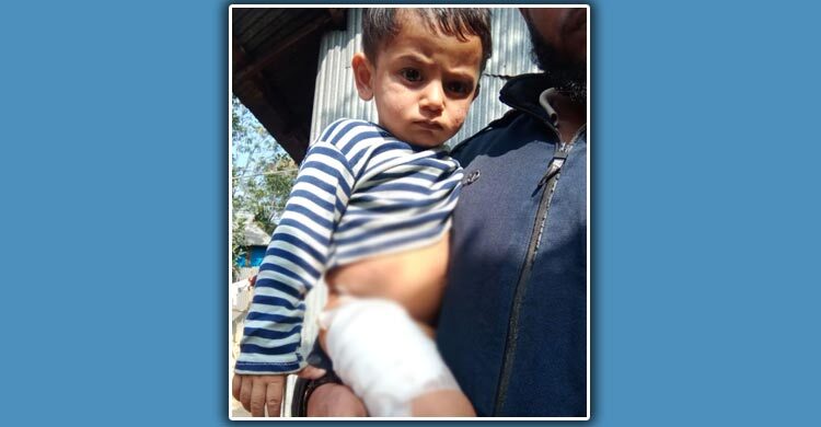 কুমিল্লায় কুকুরের কামড়ে শিশুসহ আহত ৮