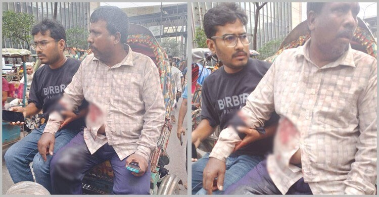 ব্যবসায়ীকে গুলি করে ১৭ হাজার ডলার ছিনতাইয়ের ঘটনায় মামলা