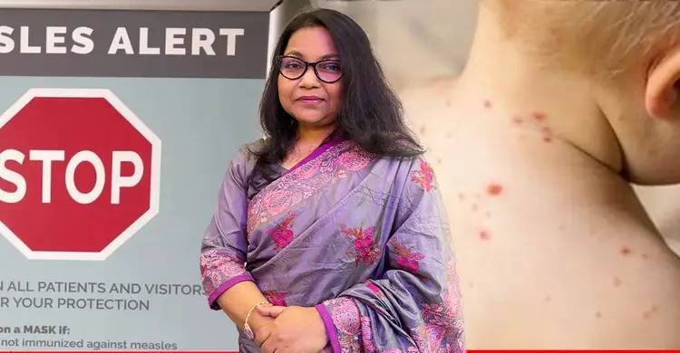 হাম নিয়ে অভিভাবকদের সতর্কবার্তা দিলেন চিকিৎসক