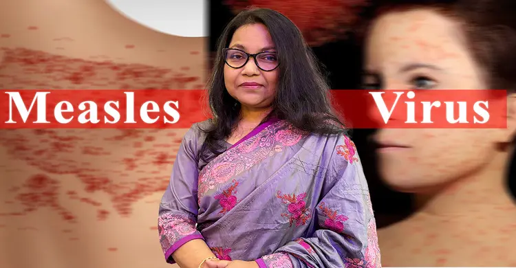 আক্রান্ত শিশু ১৫-২৮ জন শিশুর মধ্যে হাম ছড়াতে পারে