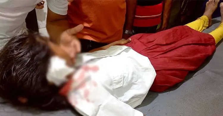 ক্লাস চলার সময় শিক্ষার্থীর মাথায় ভেঙে পড়লো ফ্যানের পাখা