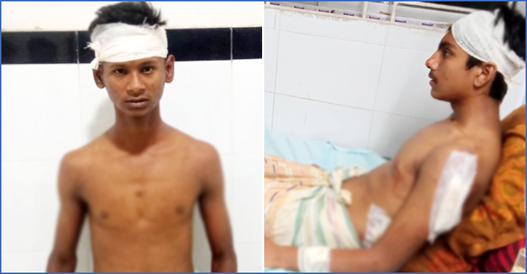 ফেসবুকে স্ট্যাটাস দিয়ে ফিল্মি স্টাইলে হামলা, আহত ২