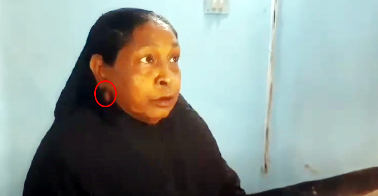 বৃদ্ধার দুই কান ছিঁড়ে দুল নিয়ে পালালেন অটোরিকশাচালক