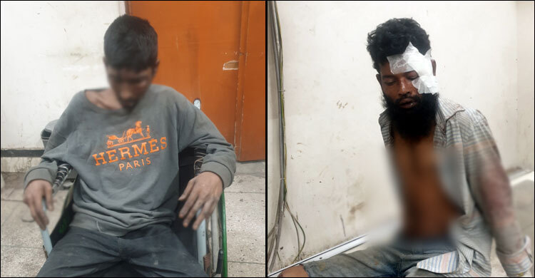 ছিনতাইকারী সন্দেহে উল্টো করে ঝুলিয়ে রাখা দুই যুবক ঢাকা মেডিকেলে