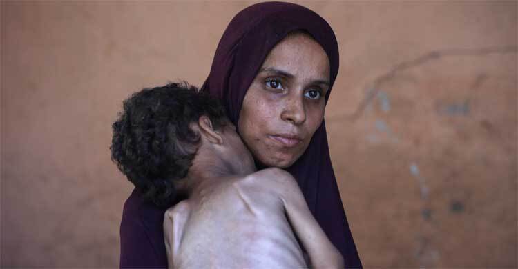 অভুক্ত অবস্থায় দিন পার করছে গাজার প্রায় এক তৃতীয়াংশ মানুষ