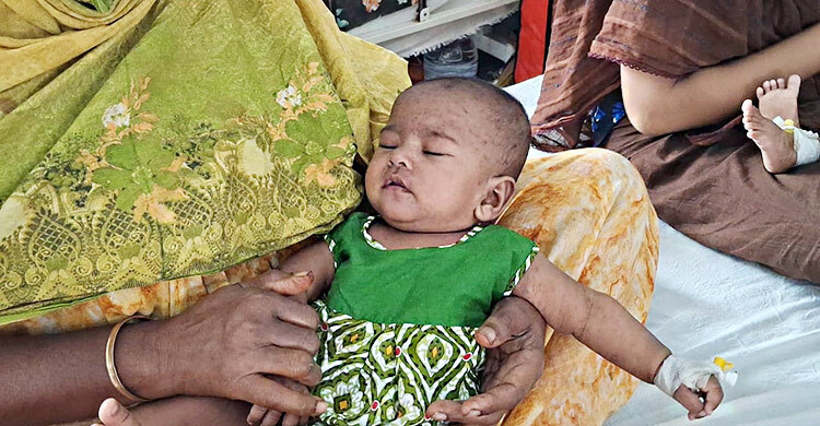 গাজীপুরে তিনদিনে হামে আক্রান্ত হয়ে হাসপাতালে ২৭ শিশু
