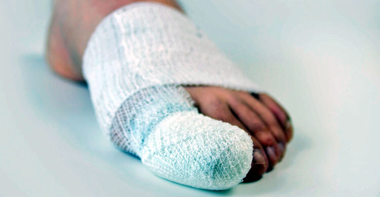 ব্যান্ডেজ বাঁধা অবস্থায় যেভাবে ফরজ গোসল করবেন