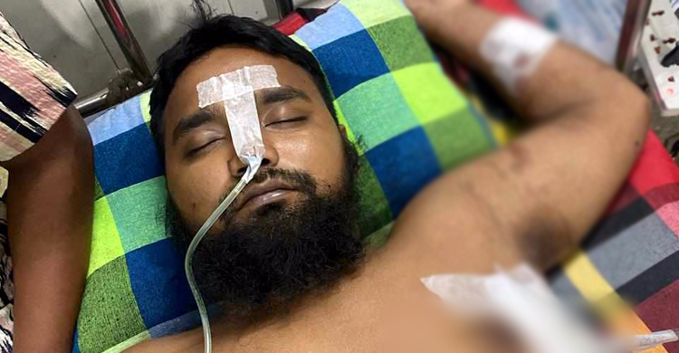 শাহআলীতে দুই পক্ষের গোলাগুলি, গুলিবিদ্ধসহ আহত ৩