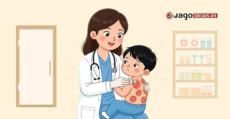 হামের উপসর্গে আরও ৪ শিশুর মৃত্যু