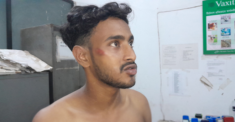 ধূমপান করতে দেখে ফেলায় দুই শিক্ষার্থীকে পিটুনি