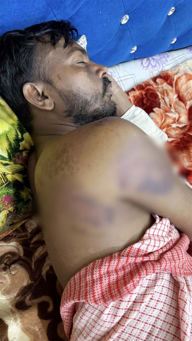 হাসপাতাল থেকে বাড়ি ফিরেছেন হিরো আলম, করবেন মামলা