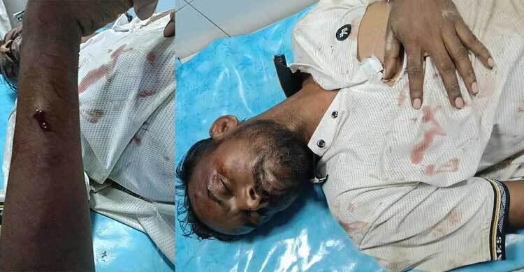 হিরো আলমের ওপর দুর্বৃত্তদের হামলা