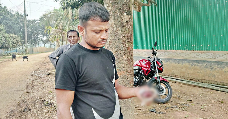 ময়মনসিংহে গরুর জিহ্বা কেটে দিলো দুর্বৃত্তরা