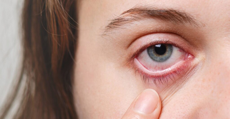 চোখে কোন লক্ষণ দেখা দিলে দ্রুত চিকিৎসকের শরণাপন্ন হবেন