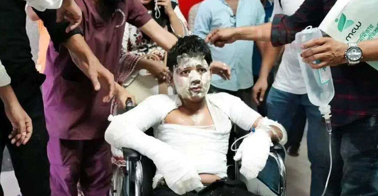 Uttara tragedy: 164 injured being treated at six hospitals