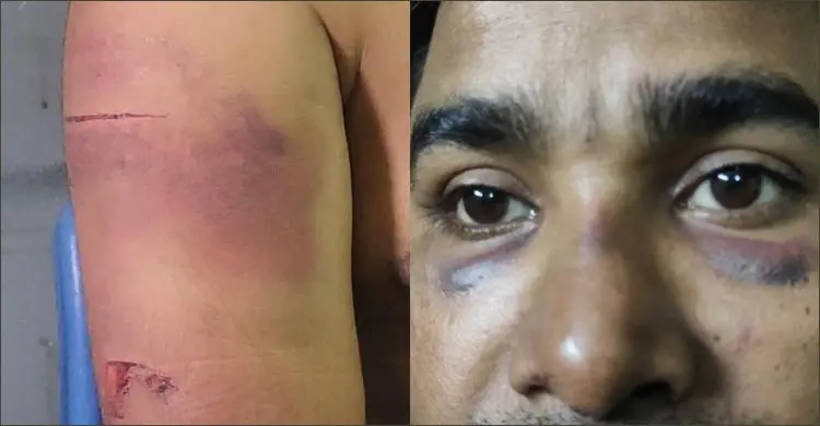 কক্সবাজারের শালিক রেস্তোরাঁর জিএমকে ঢাকায় নিয়ে নির্যাতনের অভিযোগ