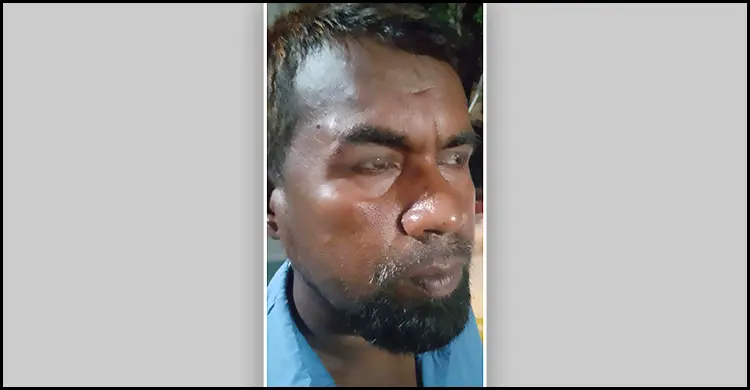 ব্রাজিলের খেলার সময় বিদ্যুৎ না থাকায় উপকেন্দ্রে হামলা