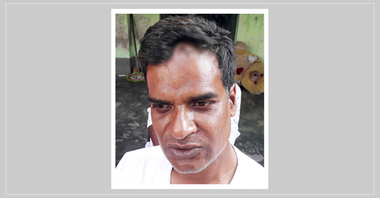 দিনাজপুরে স্বেচ্ছাসেবক লীগ নেতার বাড়িতে দুর্ধর্ষ ডাকাতি