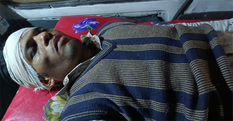 পিস্তল ঠেকিয়ে শিক্ষককে হাতুড়িপেটার অভিযোগ