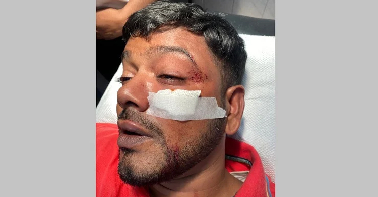 জবি ছাত্রদল সাধারণ সম্পাদকের ওপর হামলার অভিযোগ