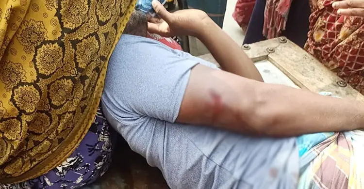 যশোরে চাঁদার দাবিতে যুবককে হাতুড়িপেটা