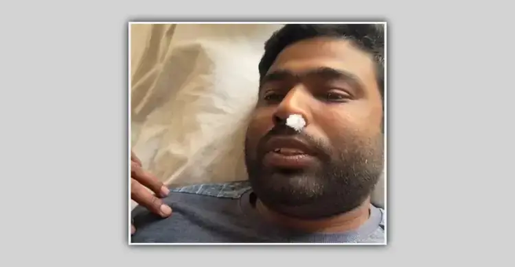 তুই মালায়ন মানুষ, ধানের শীষে ভোট দিবি ক্যান’ বলে মারধরের অভিযোগ