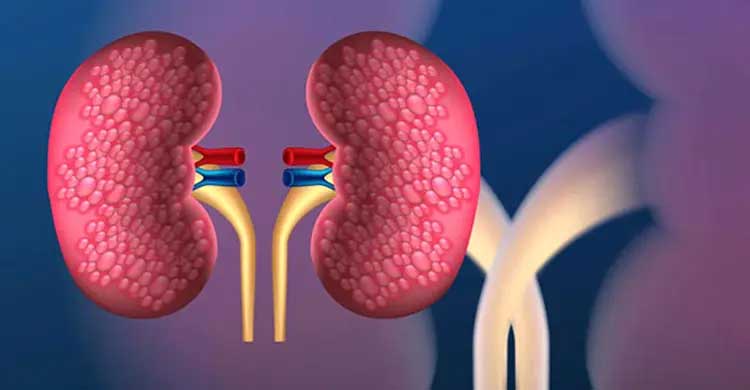 কিডনি ভালো আছে কি না বুঝবেন কীভাবে?