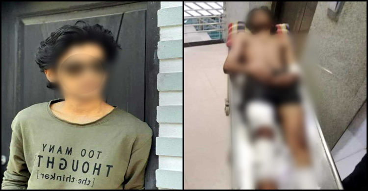 এসএসসি পরীক্ষার্থীর হাত-পায়ের রগ কাটার ঘটনায় মামলা