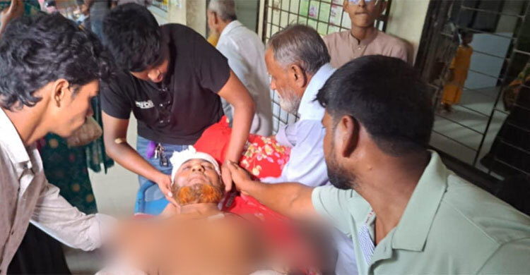 শিশুদের দ্বন্দ্বের জেরে সাংবাদিককে হাতুড়ি-লোহার রড দিয়ে মারধর