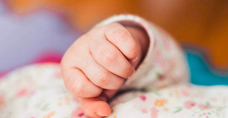 এক পা নিয়ে জন্ম নিলো শিশু, নেই প্রস্রাব-পায়খানার রাস্তা