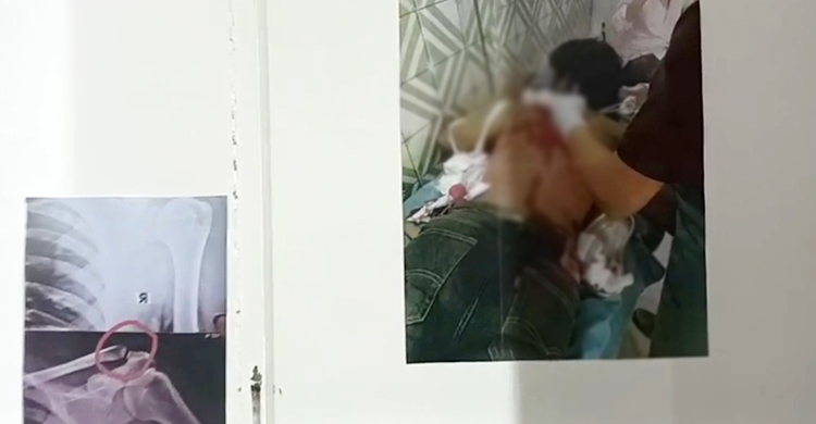 ছবিতে ছবিতে ‘রক্তাক্ত কুয়েট’