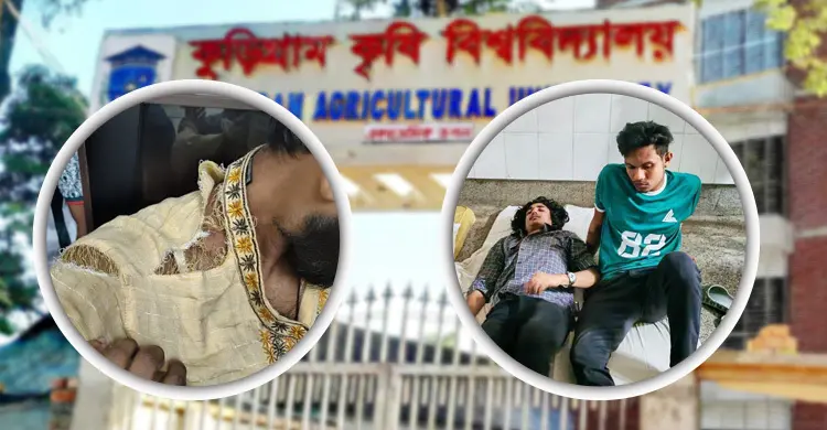 শিক্ষক-শিক্ষার্থীদের ওপর টোল প্লাজার কর্মীদের হামলা, আহত ৮