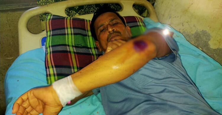 বিএনপি নেতাকে হাতুড়িপেটার অভিযোগ আ’লীগ নেতাকর্মীদের বিরুদ্ধে