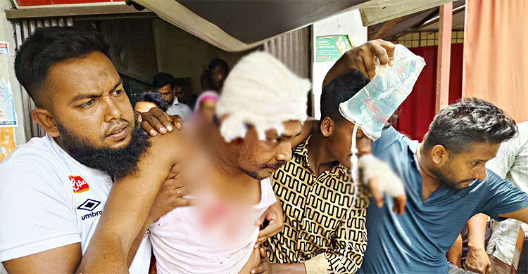 কুষ্টিয়ায় পৌর ভবনে যুবককে কুপিয়ে জখম